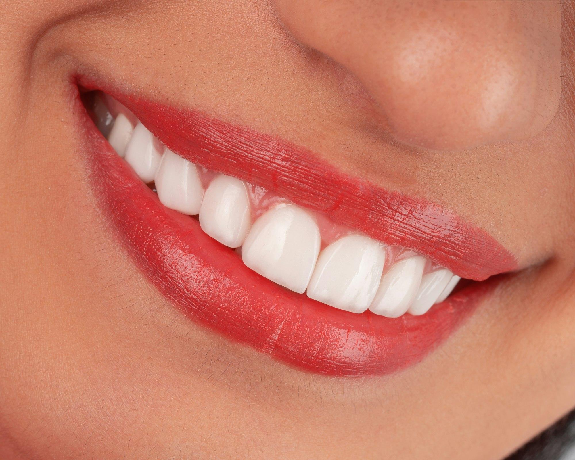Close-up of a bright, even smile